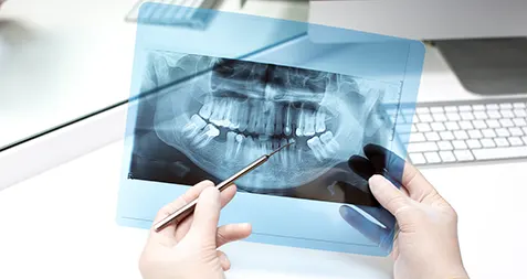 Снимок полости рта: пациенту предстоит исправление прикуса и необходима имплантация зубов